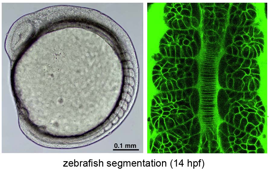 zebrafish somitogenesis